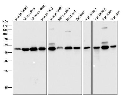 Anti-DUSP1/Mkp 1 Rabbit Monoclonal Antibody Boster Bio