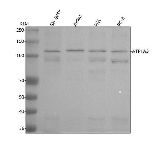 Anti-ATP1A3 Rabbit Monoclonal Antibody Boster Bio