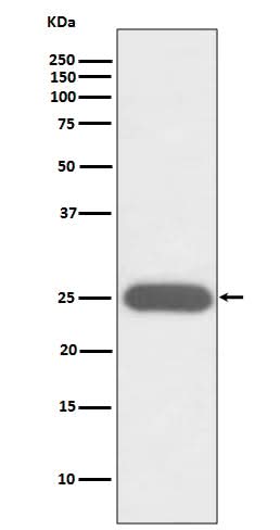 Anti-G-CSF CSF3 Rabbit Monoclonal Antibody Boster Bio