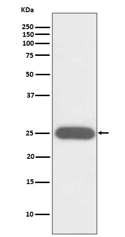 Anti-G-CSF CSF3 Rabbit Monoclonal Antibody Boster Bio