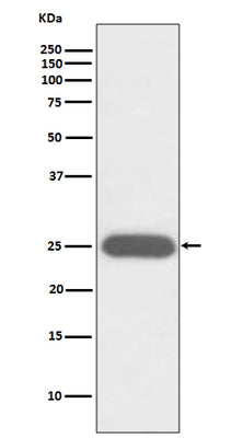 Anti-G-CSF CSF3 Rabbit Monoclonal Antibody Boster Bio
