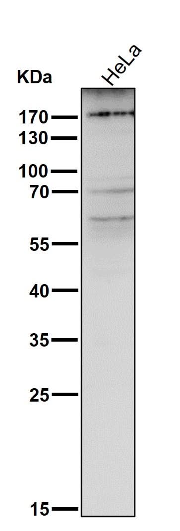Anti-MRC1/Cd206 Rabbit Monoclonal Antibody Boster Bio