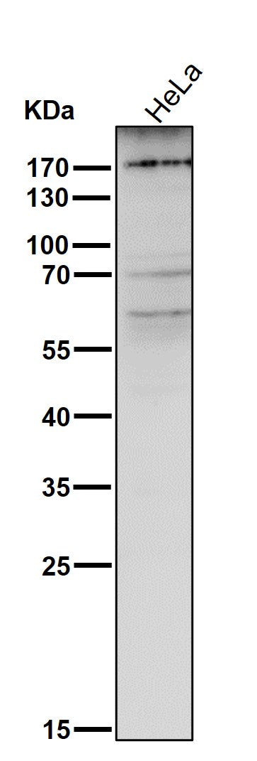Anti-MRC1/Cd206 Rabbit Monoclonal Antibody Boster Bio
