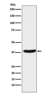 Anti-MT-ND1 Rabbit Monoclonal Antibody Boster Bio
