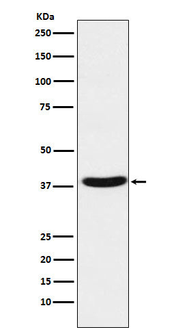 Anti-MT-ND1 Rabbit Monoclonal Antibody Boster Bio