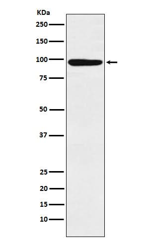 Anti-MCM4 Rabbit Monoclonal Antibody Boster Bio