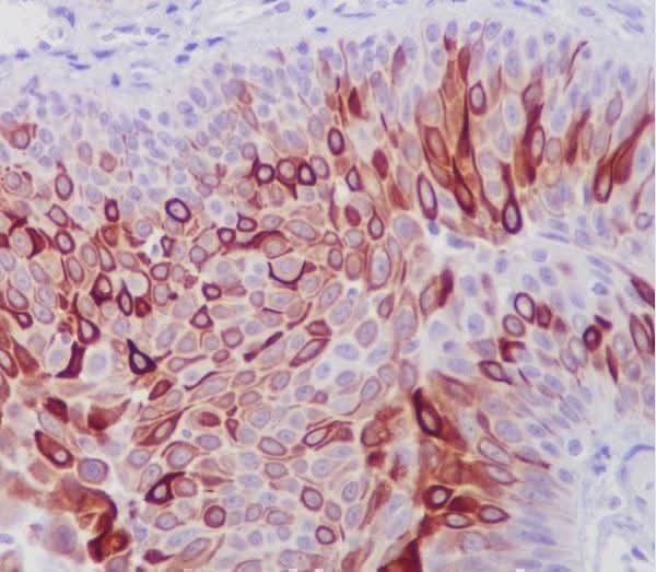 Anti-Cytokeratin 10 KRT10 Rabbit Monoclonal Antibody Boster Bio