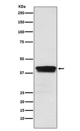 Anti-MBNL1 Rabbit Monoclonal Antibody Boster Bio