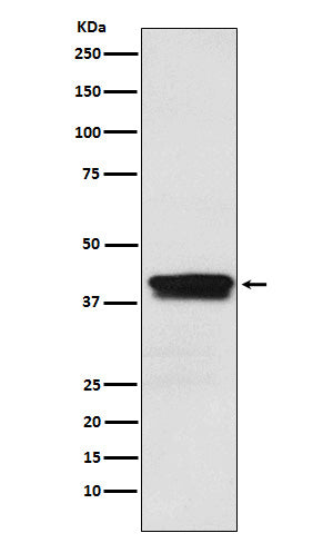 Anti-MBNL1 Rabbit Monoclonal Antibody Boster Bio