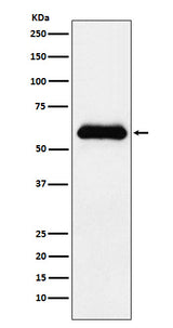 Anti-alpha 1 Antichymotrypsin SERPINA3 Monoclonal Antibody Boster Bio