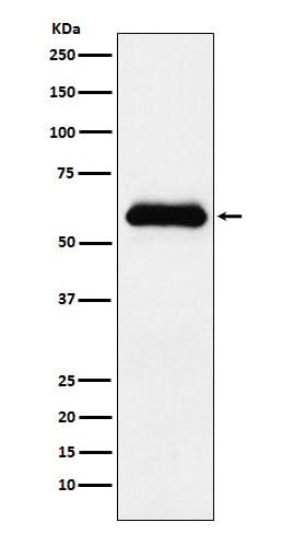 Anti-alpha 1 Antichymotrypsin SERPINA3 Monoclonal Antibody Boster Bio
