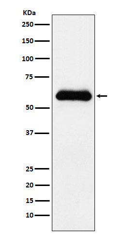 Anti-alpha 1 Antichymotrypsin SERPINA3 Monoclonal Antibody Boster Bio