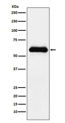 Anti-alpha 1 Antichymotrypsin SERPINA3 Monoclonal Antibody Boster Bio