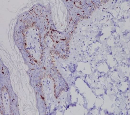Anti-Langerin (CD207) Rabbit Monoclonal Antibody Boster Bio