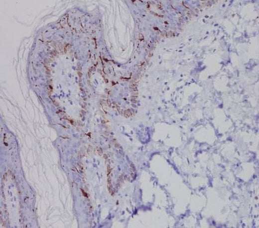 Anti-Langerin (CD207) Rabbit Monoclonal Antibody Boster Bio