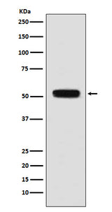 Anti-Fibulin 5 Rabbit Monoclonal Antibody Boster Bio