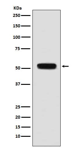 Anti-Fibulin 5 Rabbit Monoclonal Antibody Boster Bio