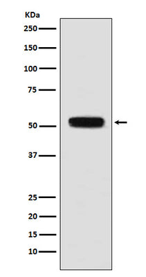 Anti-Fibulin 5 Rabbit Monoclonal Antibody Boster Bio