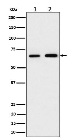 Anti-PGM1 Rabbit Monoclonal Antibody Boster Bio