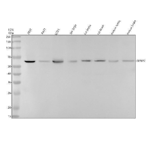 Anti-SENP2 Rabbit Monoclonal Antibody Boster Bio