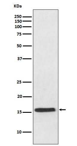 Anti-VAMP2 Rabbit Monoclonal Antibody Boster Bio