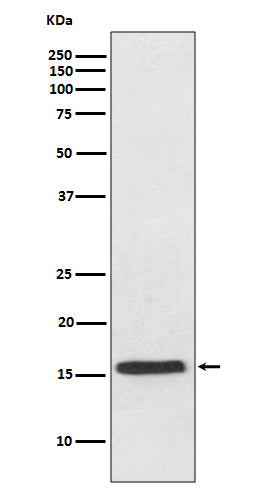 Anti-VAMP2 Rabbit Monoclonal Antibody Boster Bio