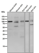 Anti-delta 1 Catenin/p120 Catenin Rabbit Monoclonal Antibody Boster Bio