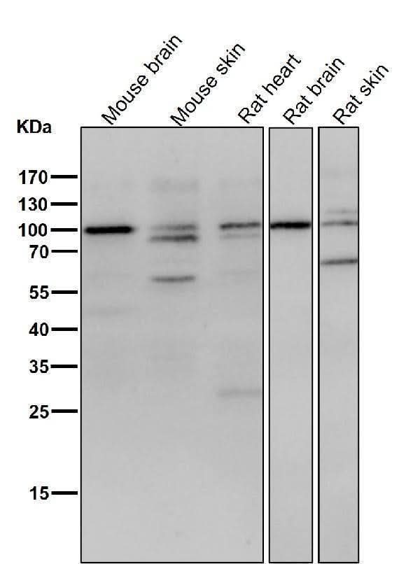Anti-delta 1 Catenin/p120 Catenin Rabbit Monoclonal Antibody Boster Bio