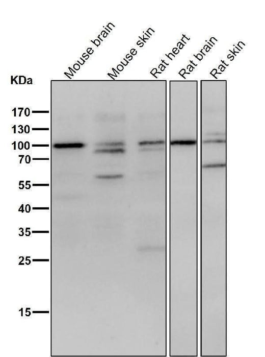 Anti-delta 1 Catenin/p120 Catenin Rabbit Monoclonal Antibody Boster Bio