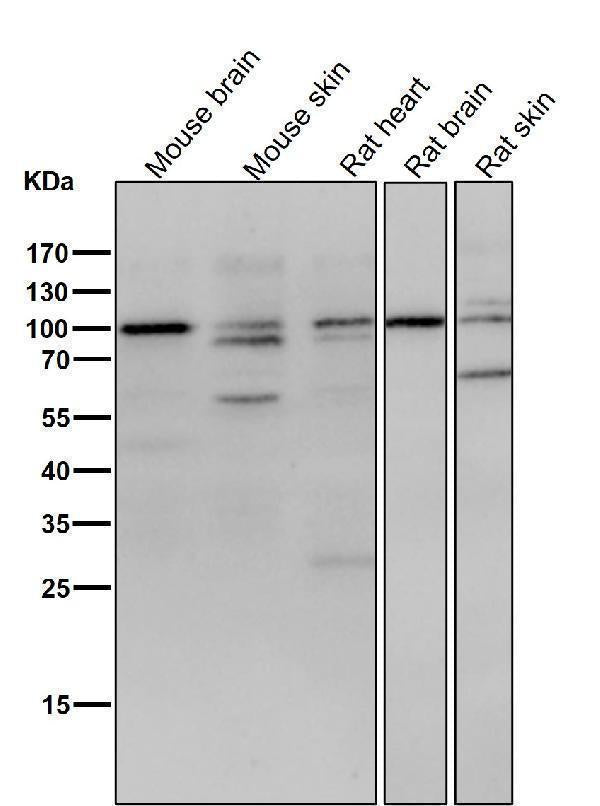 Anti-delta 1 Catenin/p120 Catenin Rabbit Monoclonal Antibody Boster Bio