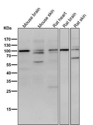 Anti-delta 1 Catenin/p120 Catenin Rabbit Monoclonal Antibody Boster Bio