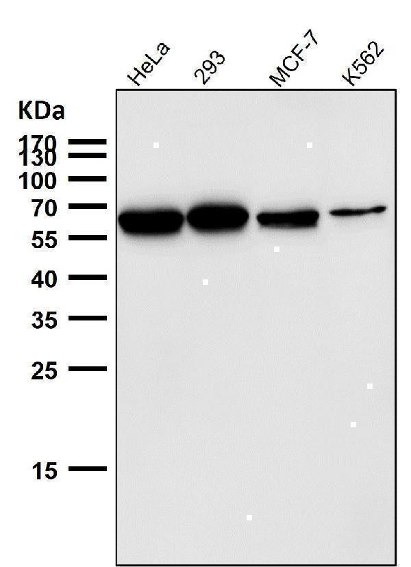 Anti-P4HB Rabbit Monoclonal Antibody Boster Bio