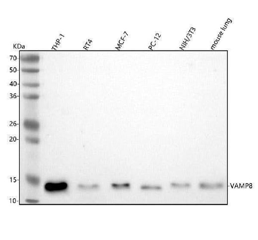 Anti-VAMP8/Endobrevin Rabbit Monoclonal Antibody Boster Bio