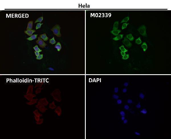 Anti-eIF3A Rabbit Monoclonal Antibody Boster Bio