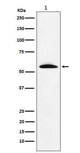 Anti-GGT1 Rabbit Monoclonal Antibody Boster Bio