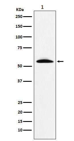 Anti-GGT1 Rabbit Monoclonal Antibody Boster Bio