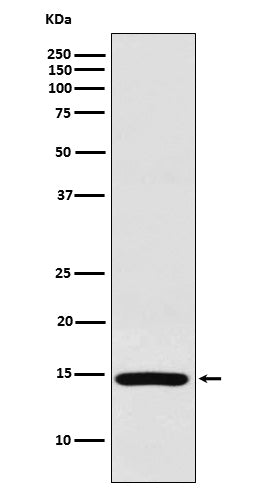 Anti-RPS19 Rabbit Monoclonal Antibody Boster Bio