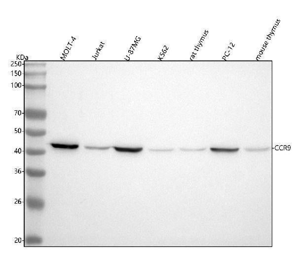 Anti-CCR9 Rabbit Monoclonal Antibody Boster Bio