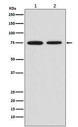 Anti-MSR1 Rabbit Monoclonal Antibody Boster Bio