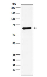 Anti-STXBP1 Rabbit Monoclonal Antibody Boster Bio
