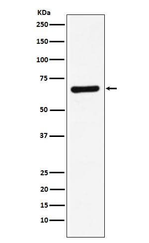 Anti-STXBP1 Rabbit Monoclonal Antibody Boster Bio