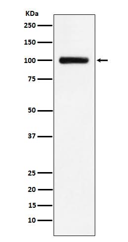 Anti-Transferrin Receptor 2 Rabbit Monoclonal Antibody Boster Bio