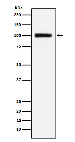 Anti-Transferrin Receptor 2 Rabbit Monoclonal Antibody Boster Bio