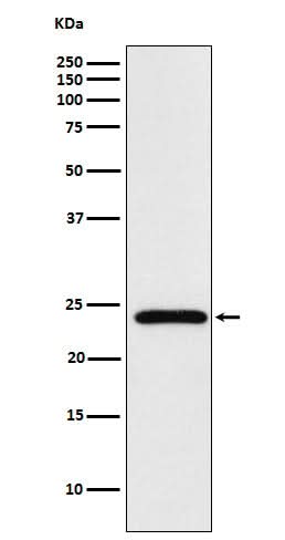 Anti-Mad2L2 Monoclonal Antibody Boster Bio