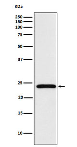 Anti-Mad2L2 Monoclonal Antibody Boster Bio