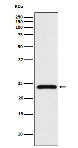 Anti-Mad2L2 Monoclonal Antibody Boster Bio