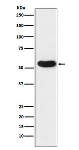 Anti-CHRNA5 Rabbit Monoclonal Antibody Boster Bio
