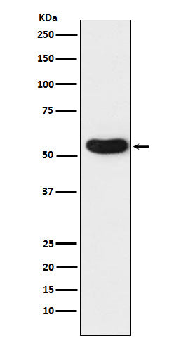 Anti-CHRNA5 Rabbit Monoclonal Antibody Boster Bio