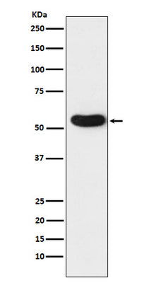 Anti-CHRNA5 Rabbit Monoclonal Antibody Boster Bio
