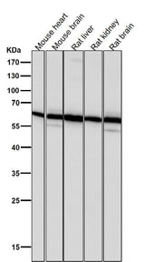 Anti-PMP70 ABCD3 Monoclonal Antibody Boster Bio